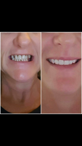 Labrador Denture Clinic - Dentists Australia 4