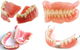 Noble Denture Design - thumb 1