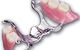 Noble Denture Design - thumb 2