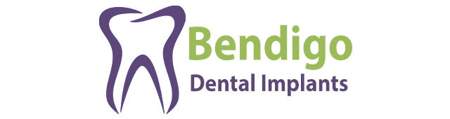 Bendigo Dental Implants
