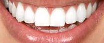 Bendigo Dentist On Hargreaves