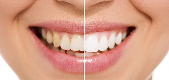 All About Smiles Kincumber