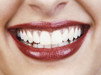 Rosenthal Dental Surgery - Dentists Australia 0