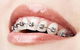 Dental Centre Buderim - thumb 4