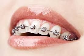 Dental Centre Buderim - Dentists Australia 9