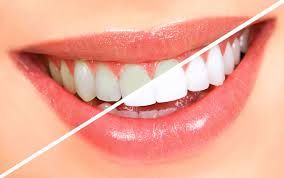 Dental Centre Buderim - Dentists Australia 10