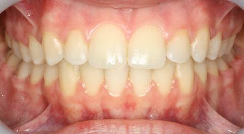 Tamworth Orthocare - Dentists Australia 3