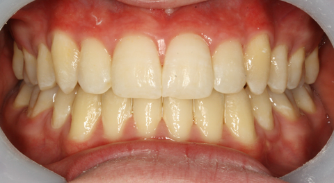 Tamworth Orthocare - Dentists Australia 13