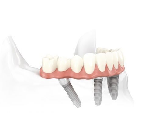 Specialist Oral Surgery