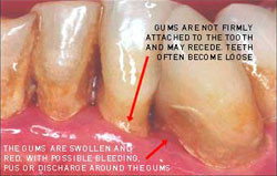 Crown Dental Surgery