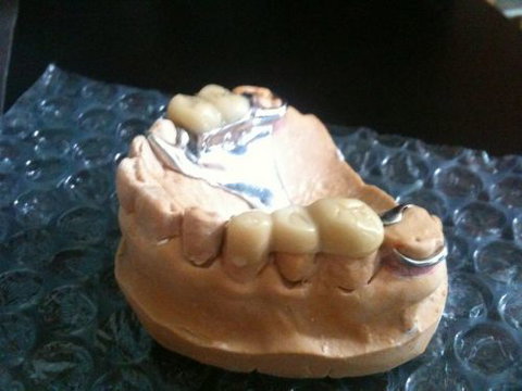 Northside Denture Clinic - Dentists Australia 7