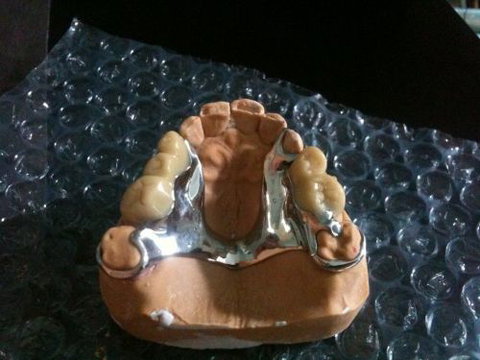 Northside Denture Clinic - Dentists Australia 8