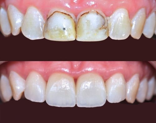 Clear Dental Chatswood