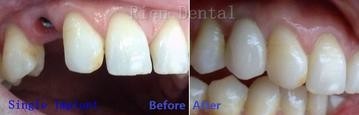 Rien Dental - Dentists Australia 0