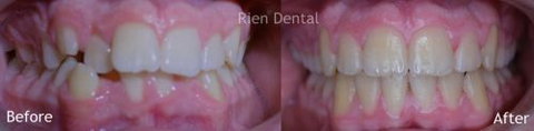 Rien Dental - Dentists Australia 1