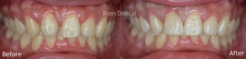 Rien Dental - Dentists Australia 2
