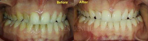 Rien Dental - Dentists Australia 3