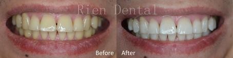Rien Dental - Dentists Australia 5