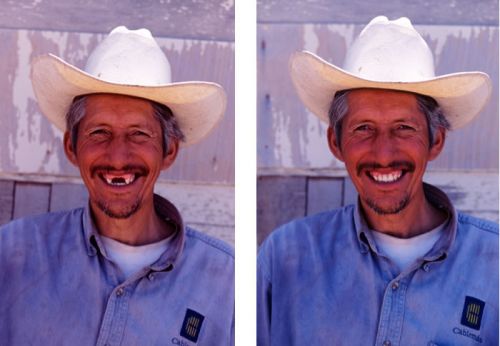 Denture Mt Gravatt
