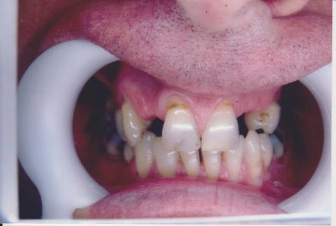 International Smiles - Dentists Australia 1