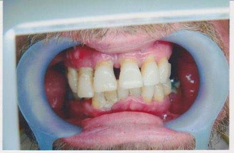 International Smiles - Dentists Australia 3