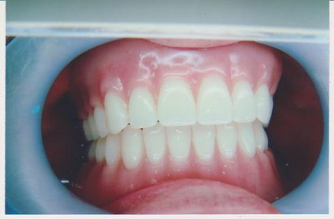 International Smiles - Dentists Australia 4