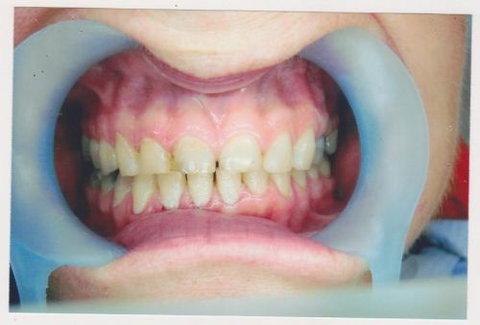 International Smiles - Dentists Australia 5
