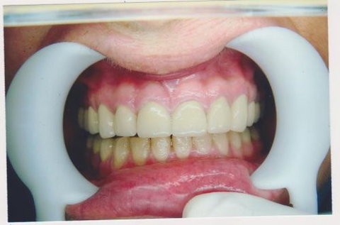 International Smiles - Dentists Australia 6