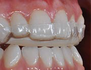 Hermitage Dental - Dentists Australia 4