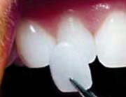 Hermitage Dental - Dentists Australia 6