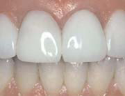 Hermitage Dental - Dentists Australia 7