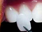 Hermitage Dental - Dentists Australia 16