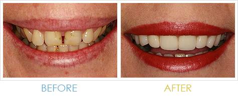 Harris Dental Boutique - Dentists Australia 1