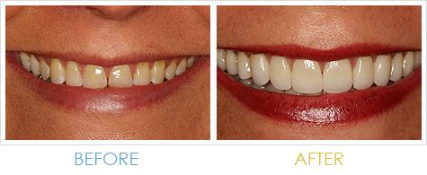 Harris Dental Boutique - Dentists Australia 2