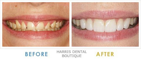 Harris Dental Boutique - Dentists Australia 9