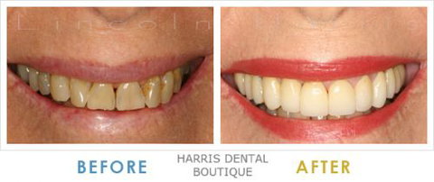 Harris Dental Boutique - Dentists Australia 10