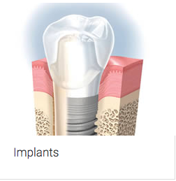 Aura Dental Centre - Dentists Australia 6
