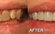 Ooralea Dental Care - thumb 4