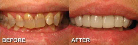 Ooralea Dental Care - Dentists Australia 4