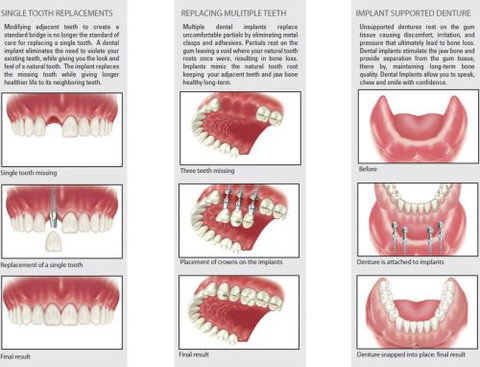 Ooralea Dental Care - Dentists Australia 5