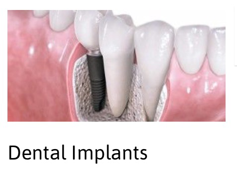 A2Z Dental - Dentists Australia 9